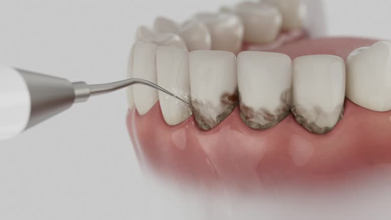 Trusted Dental Crowns And Bridges service in Lillian, AL - Dentist Open Now